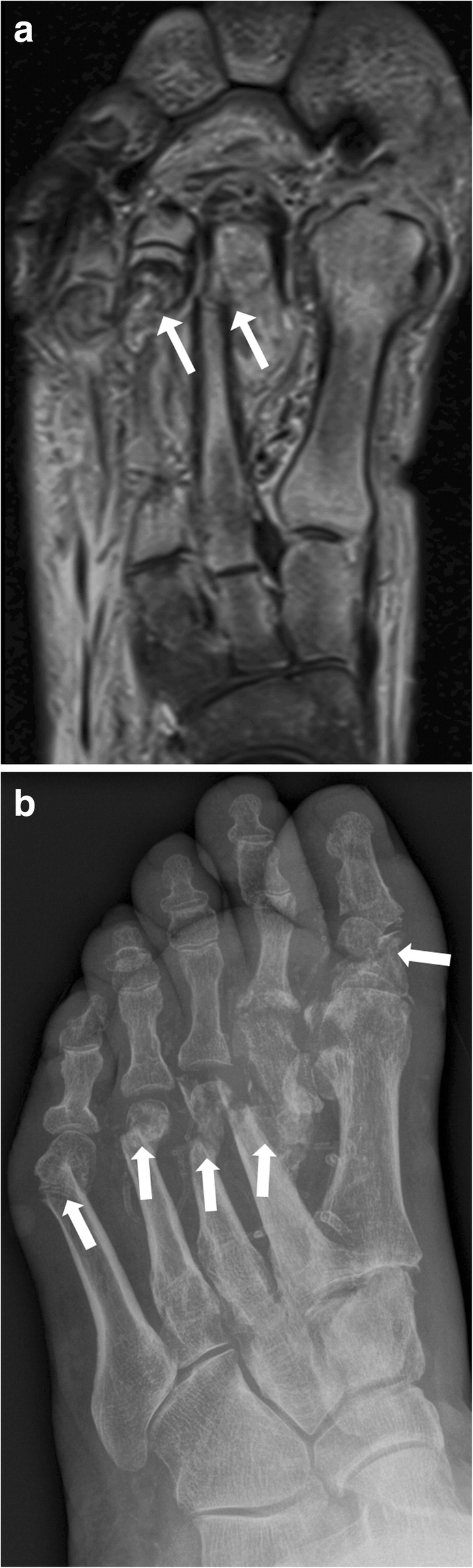 Fig. 16