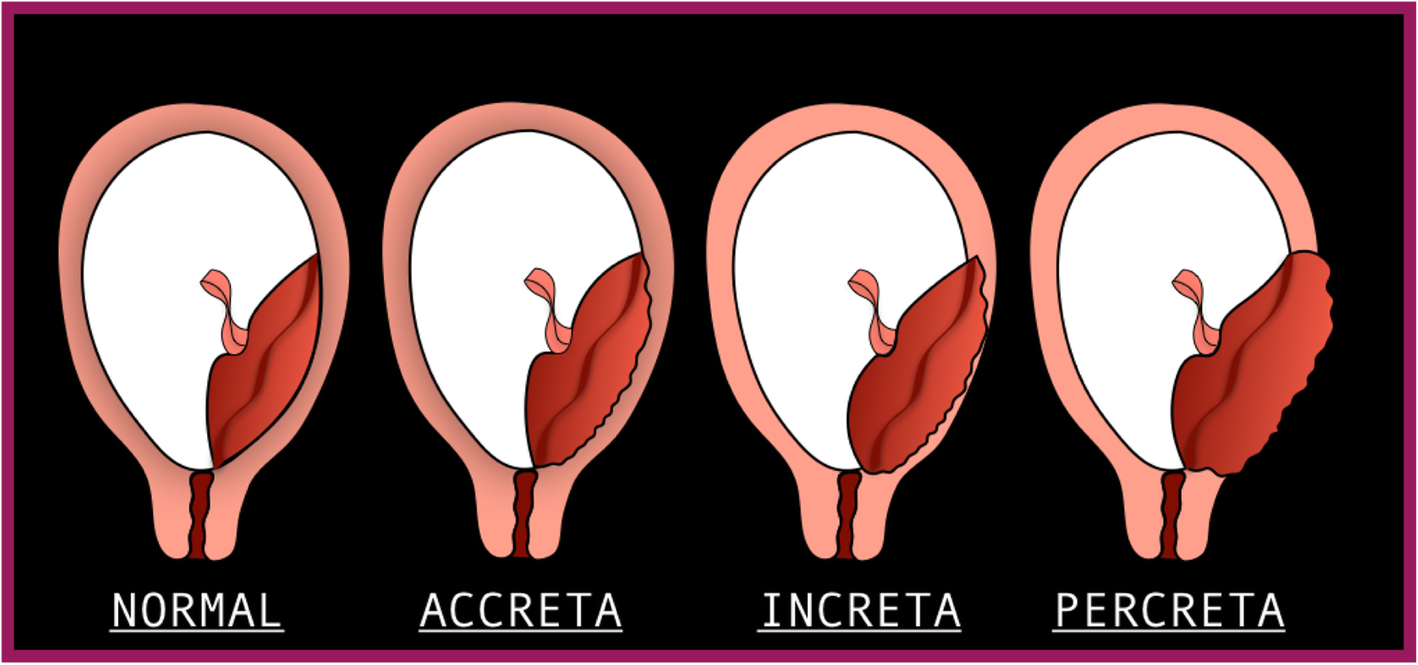 Fig. 15