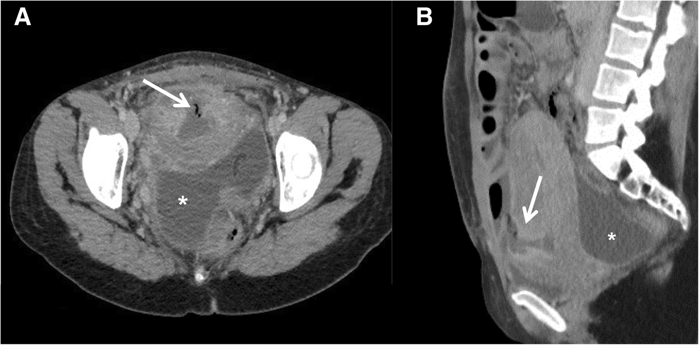 Fig. 5