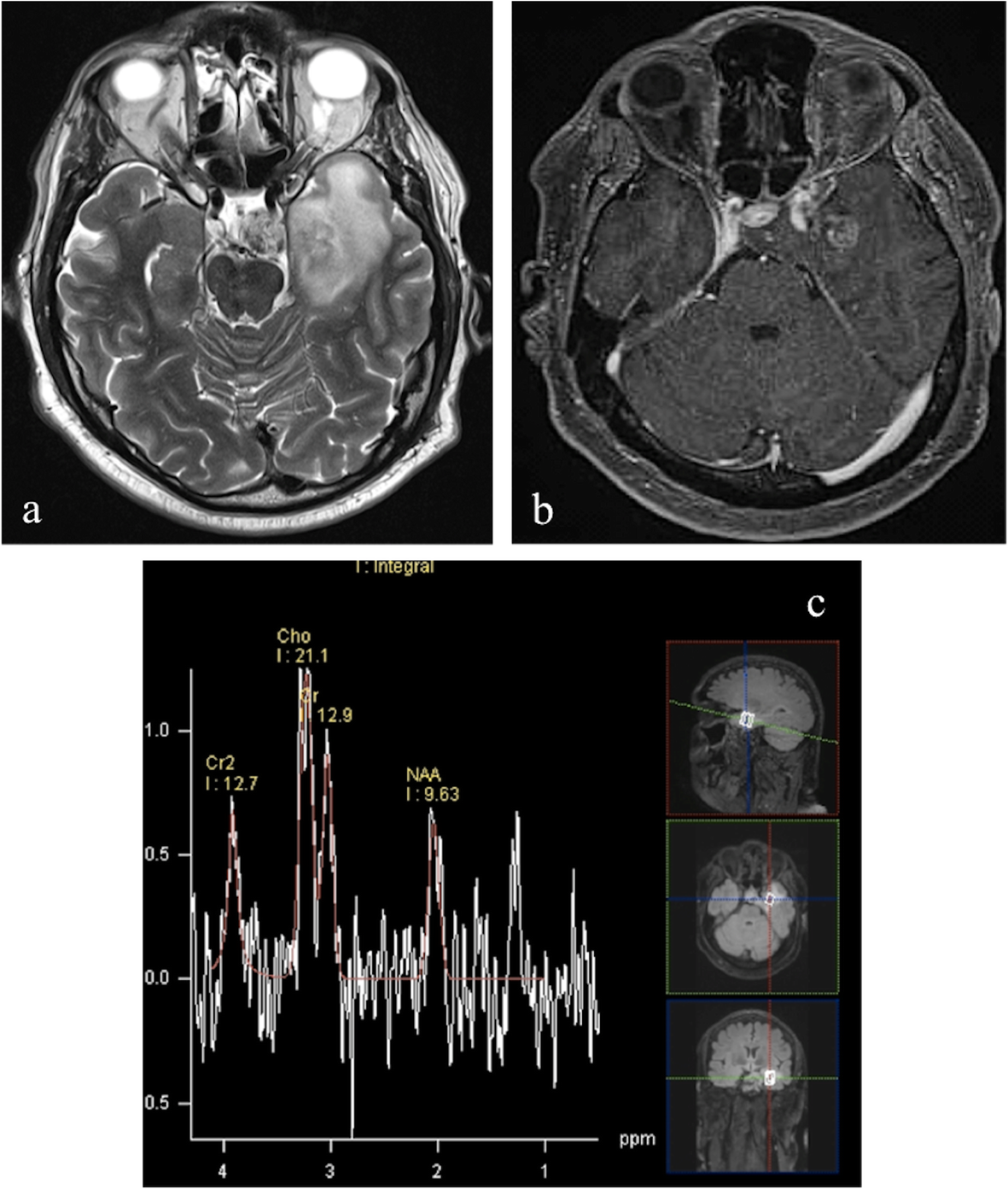 Fig. 9