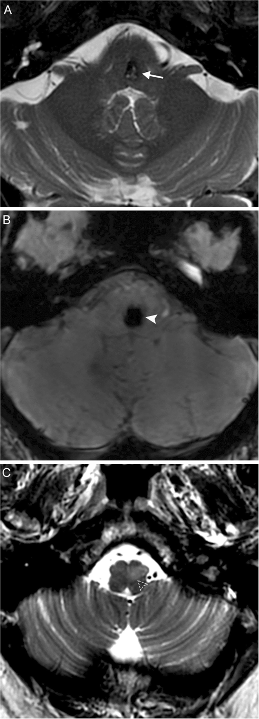 Fig. 10