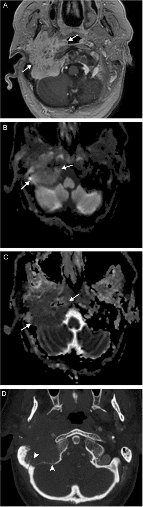 Fig. 16