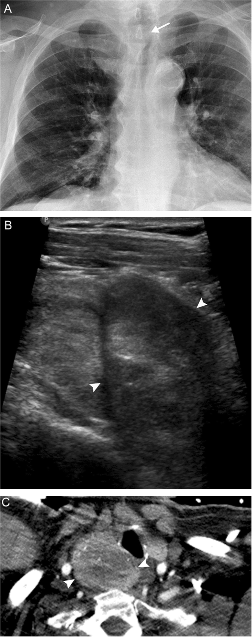 Fig. 18