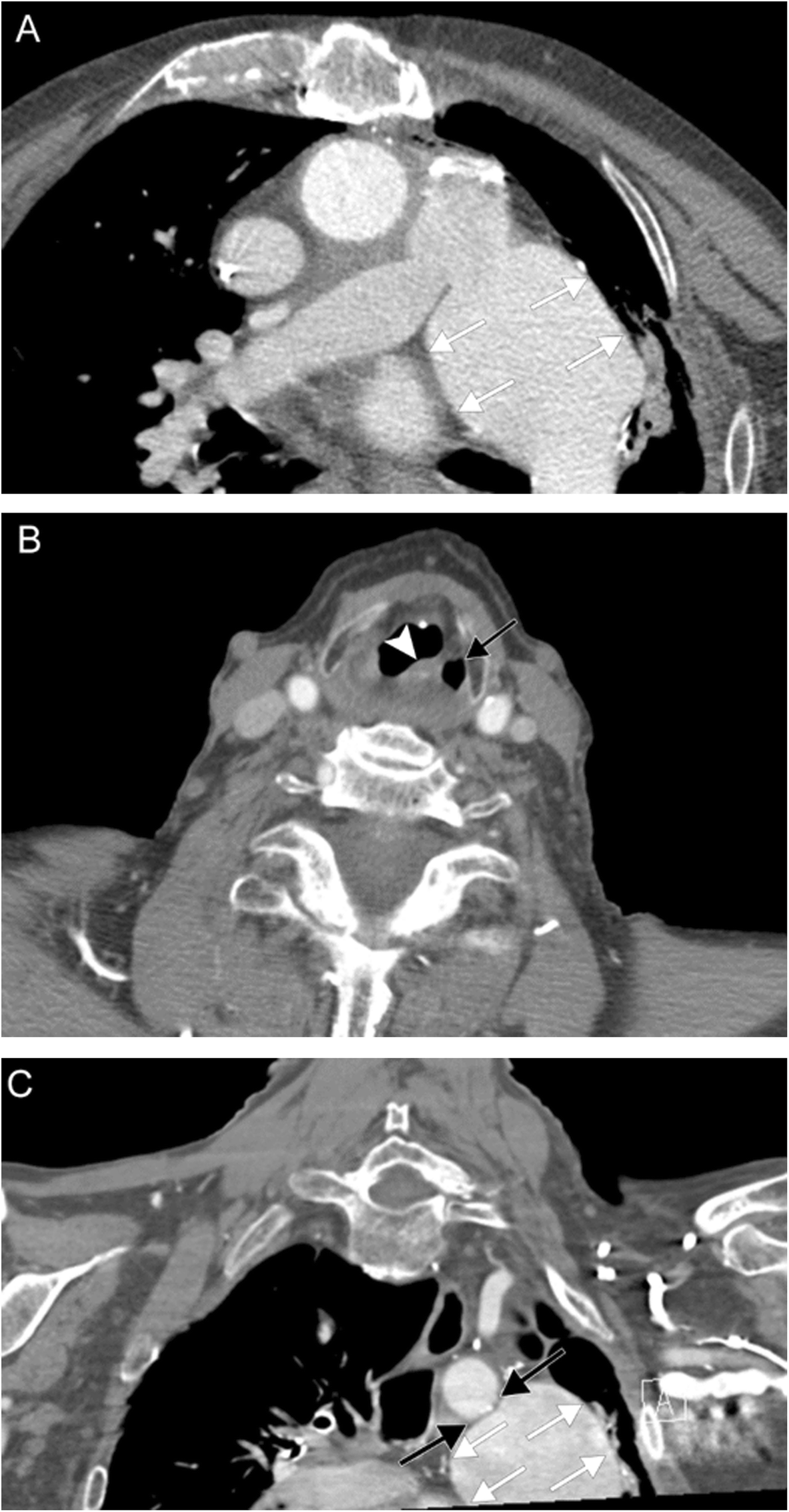 Fig. 22