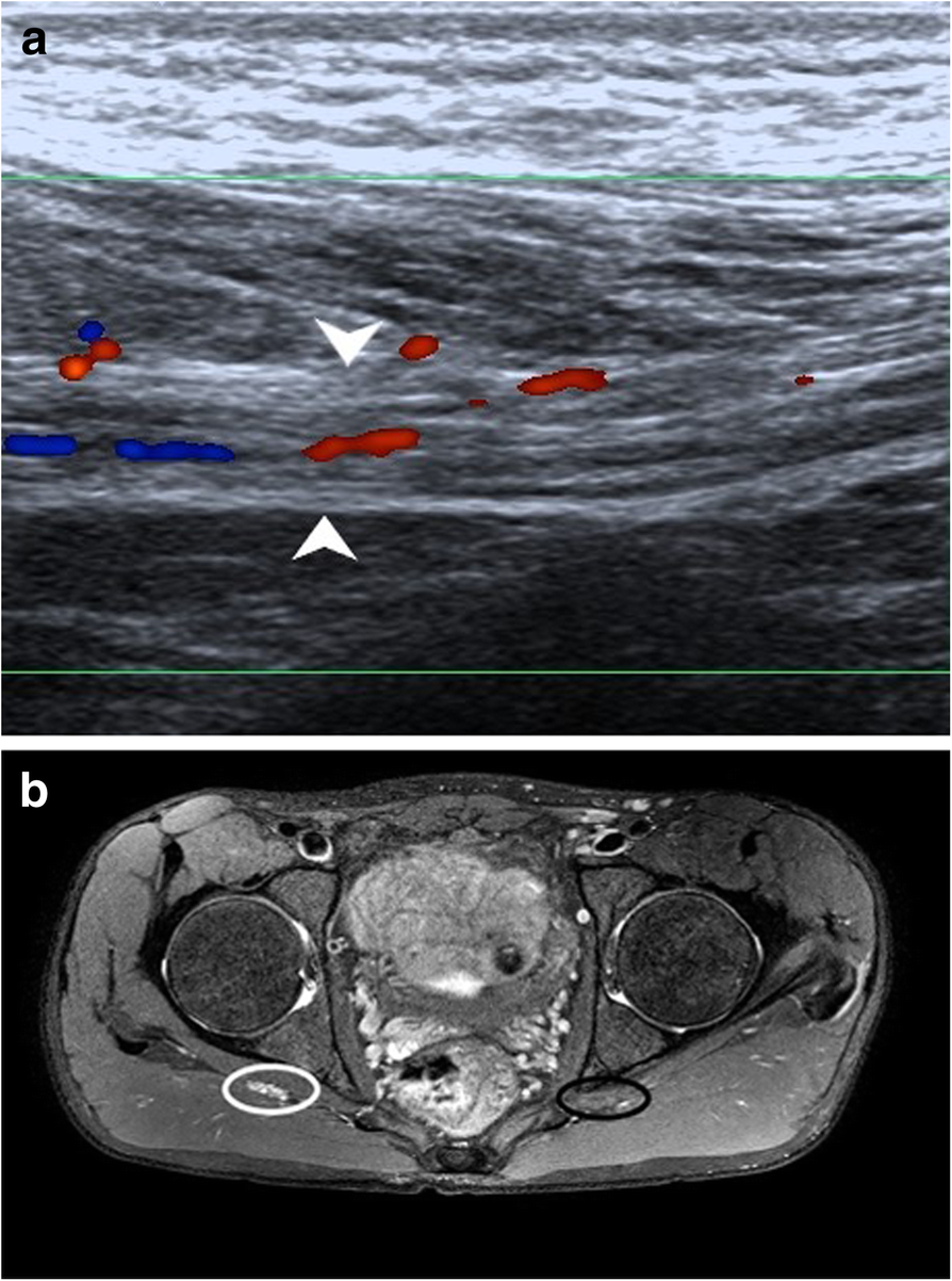 Fig. 13