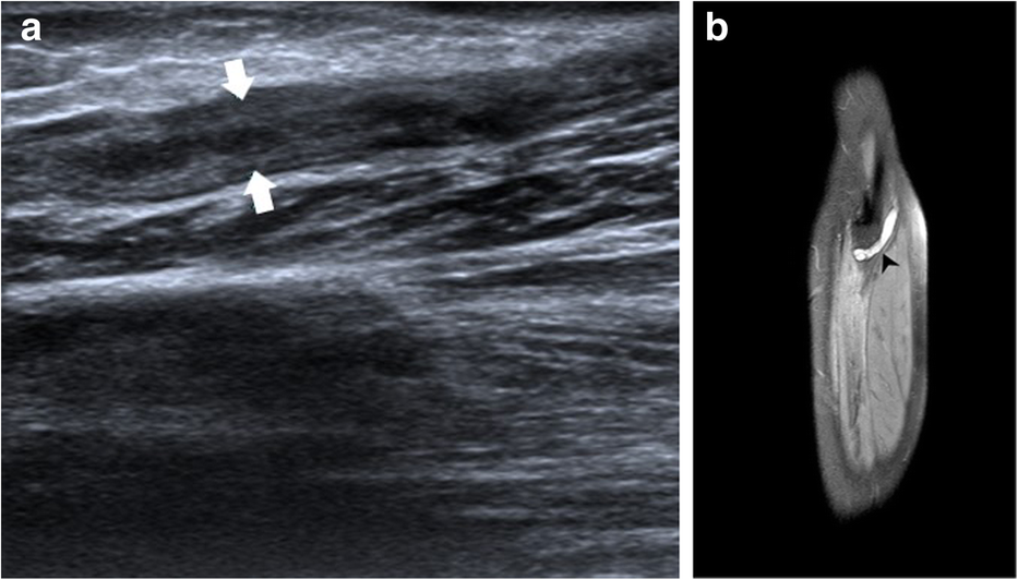 Fig. 14