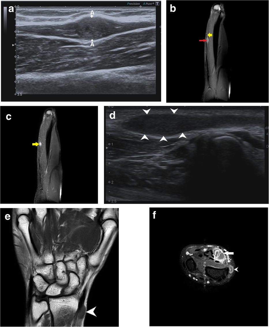 Fig. 15