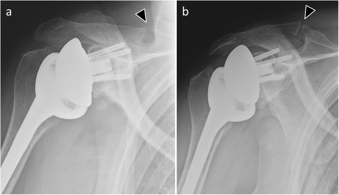 Fig. 14