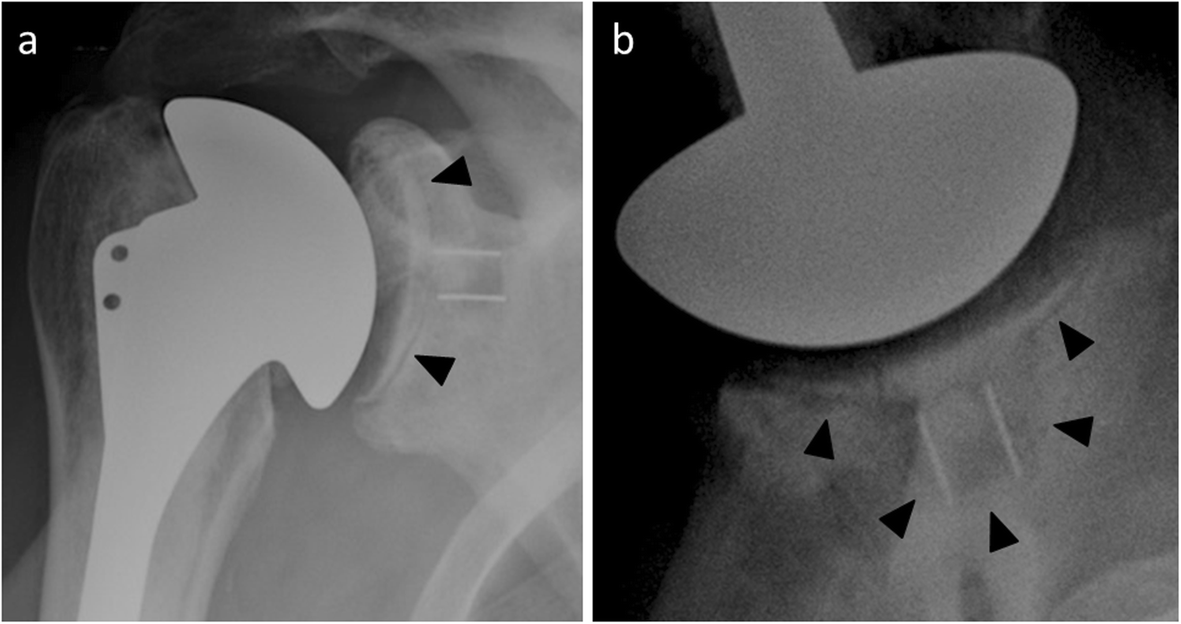 Fig. 16