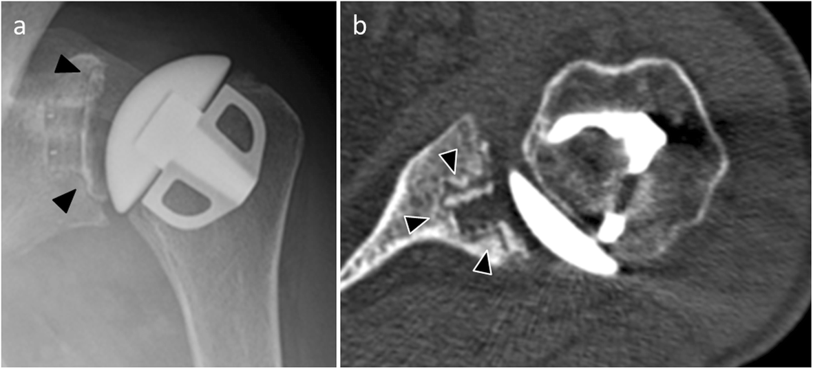 Fig. 17