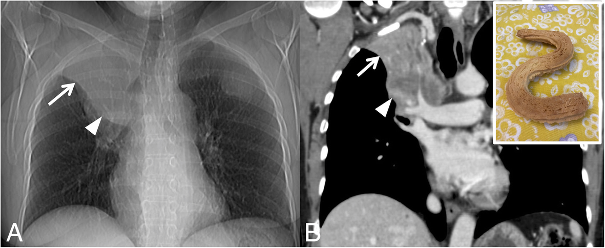 Fig. 17