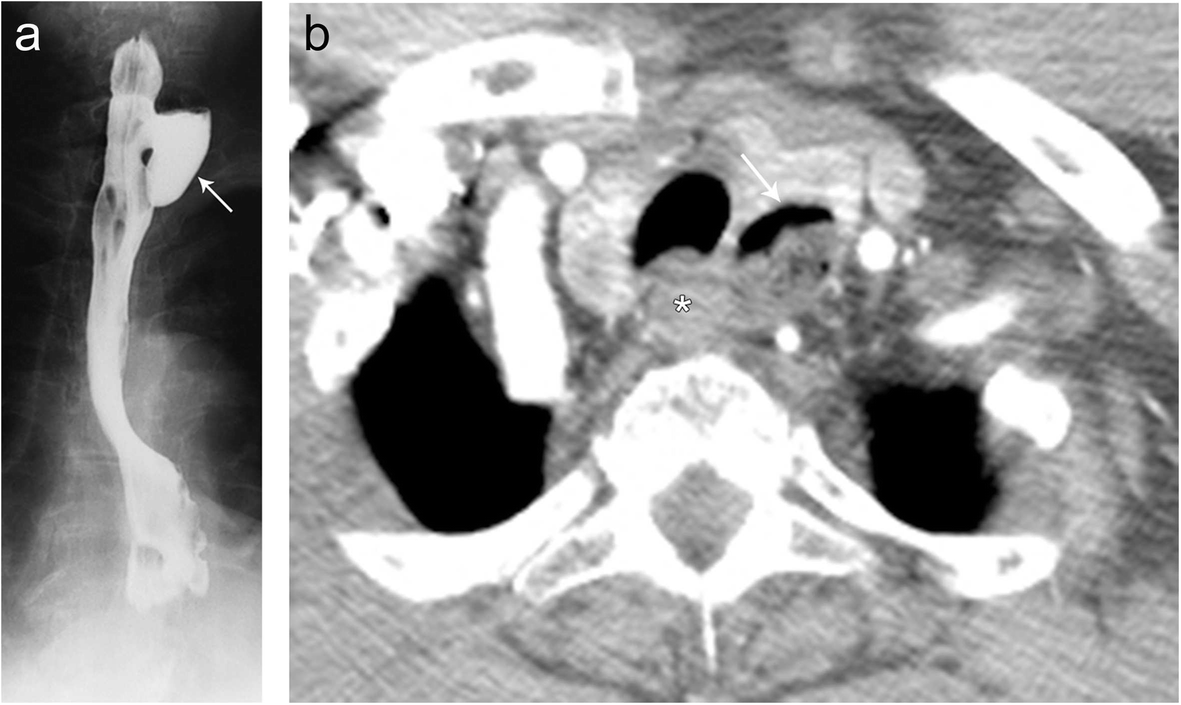 Fig. 14