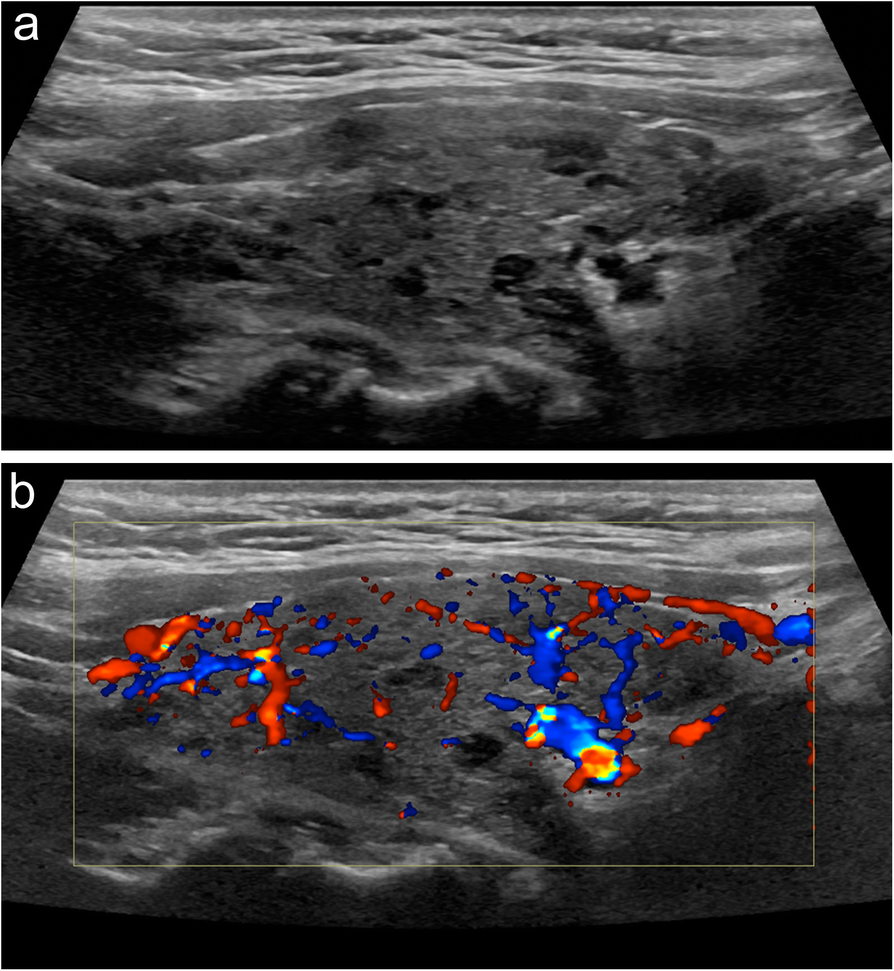 Fig. 21