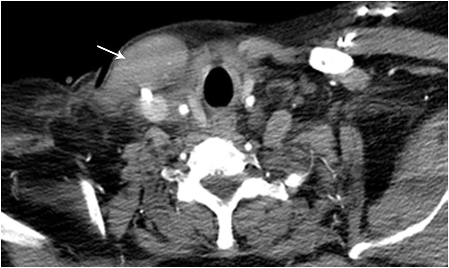 Fig. 25