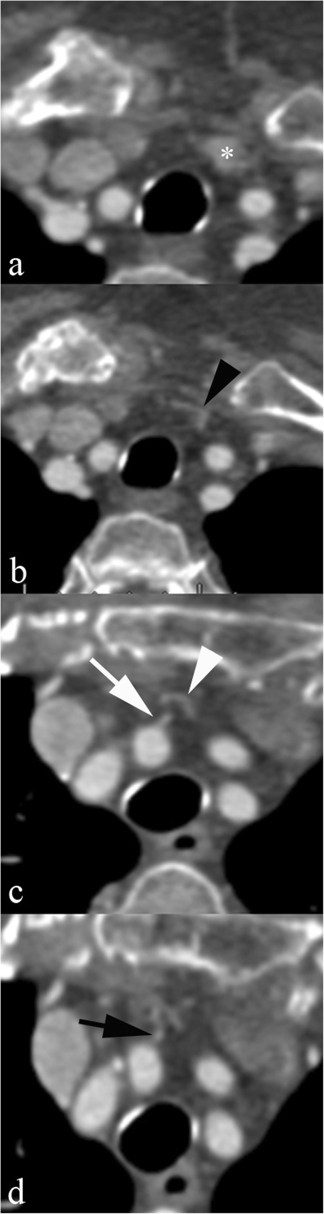 Fig. 10