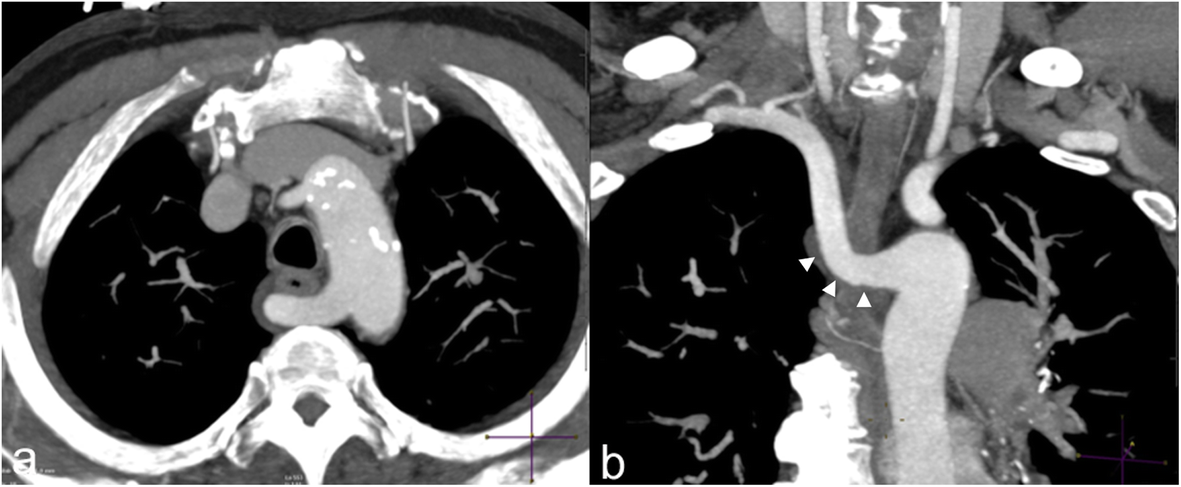 Fig. 16