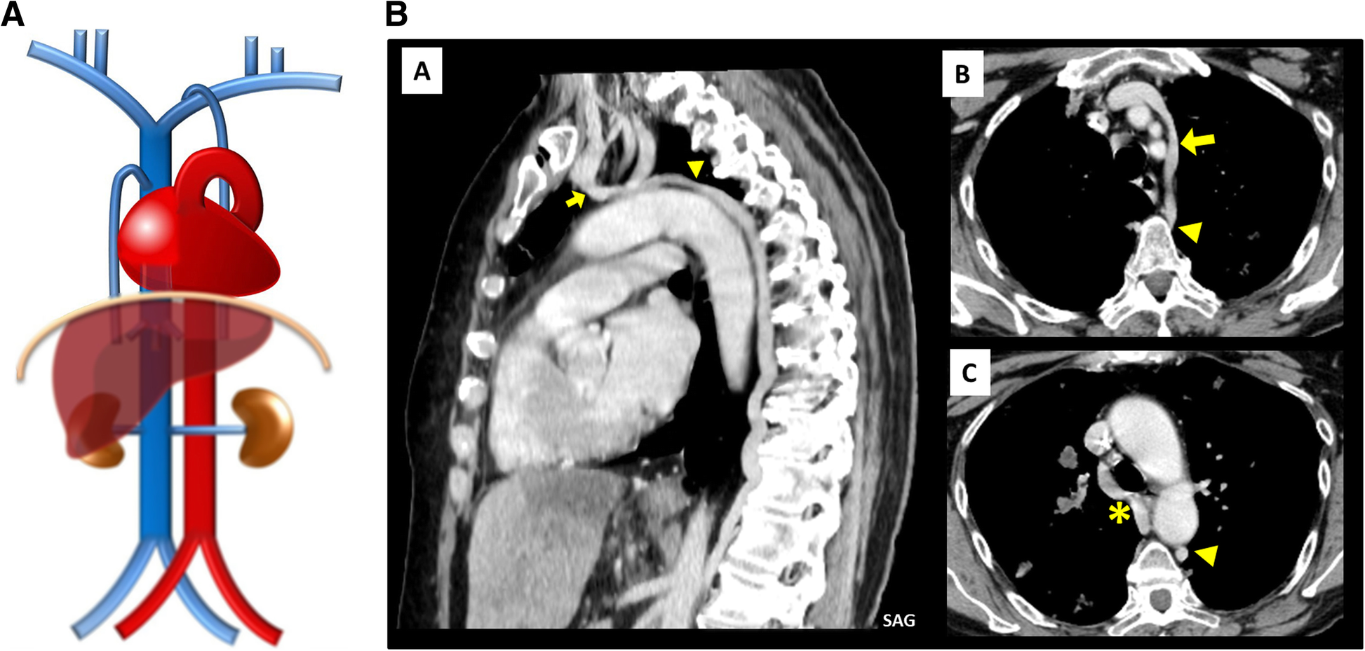 Fig. 17