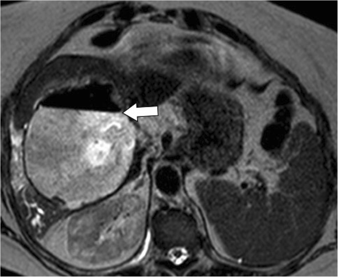 Fig. 13