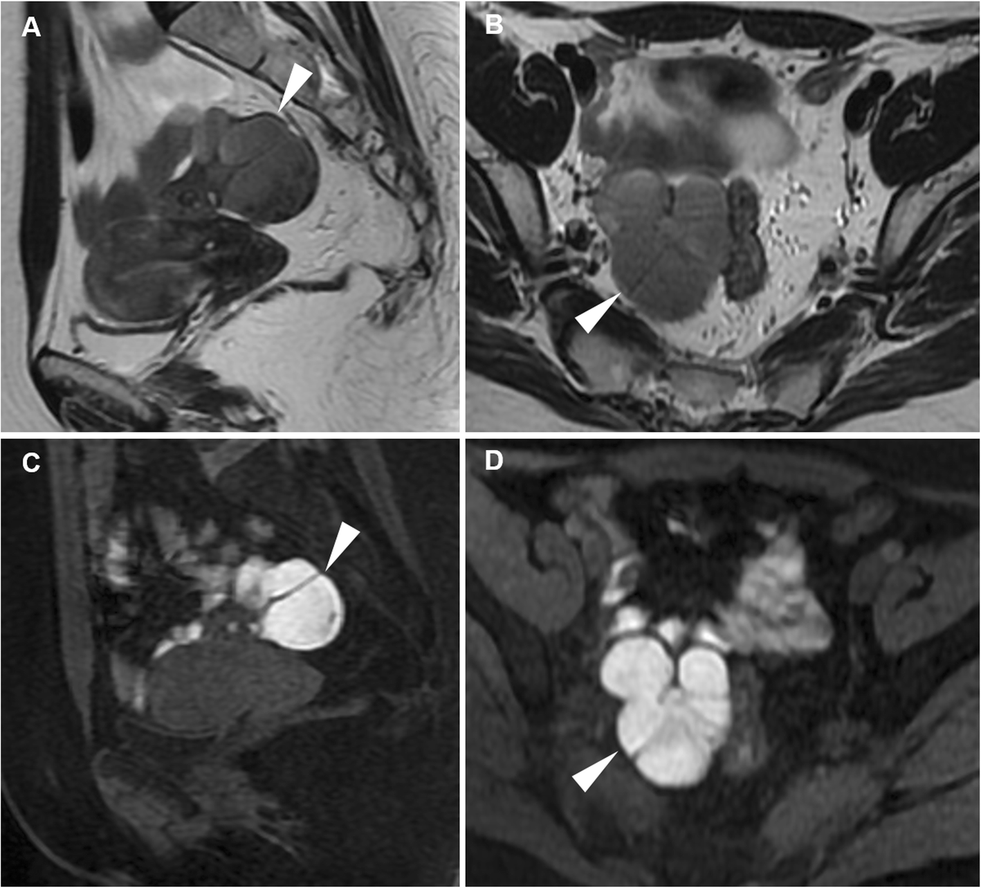 Fig. 18