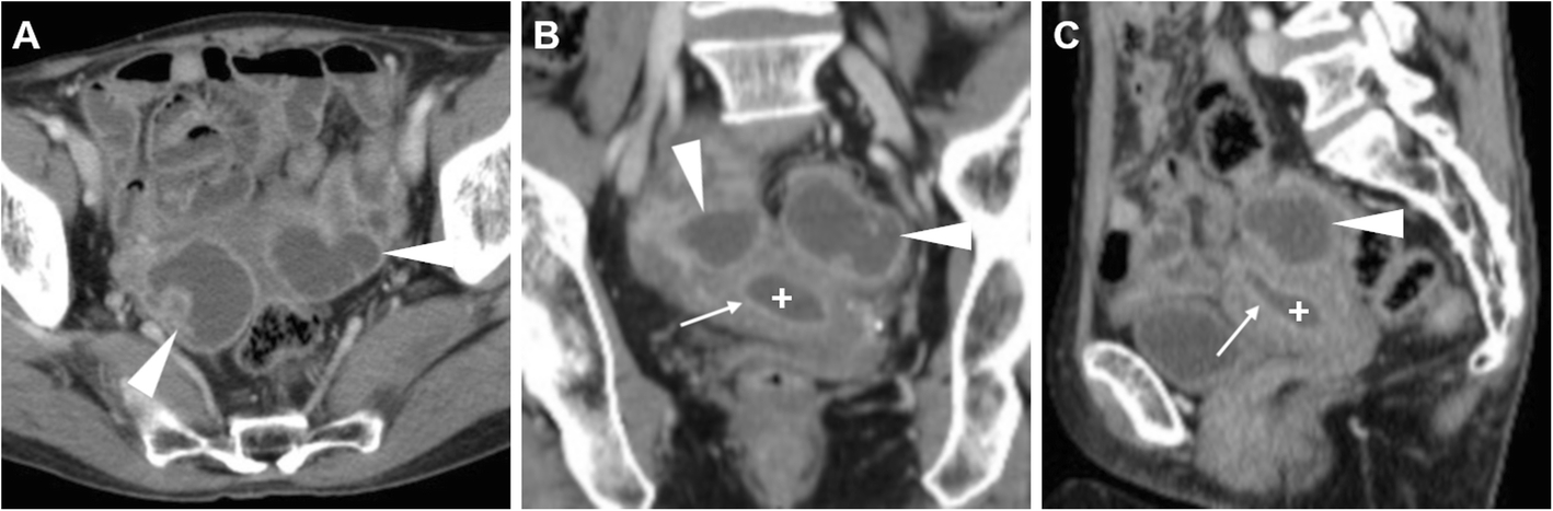 Fig. 22