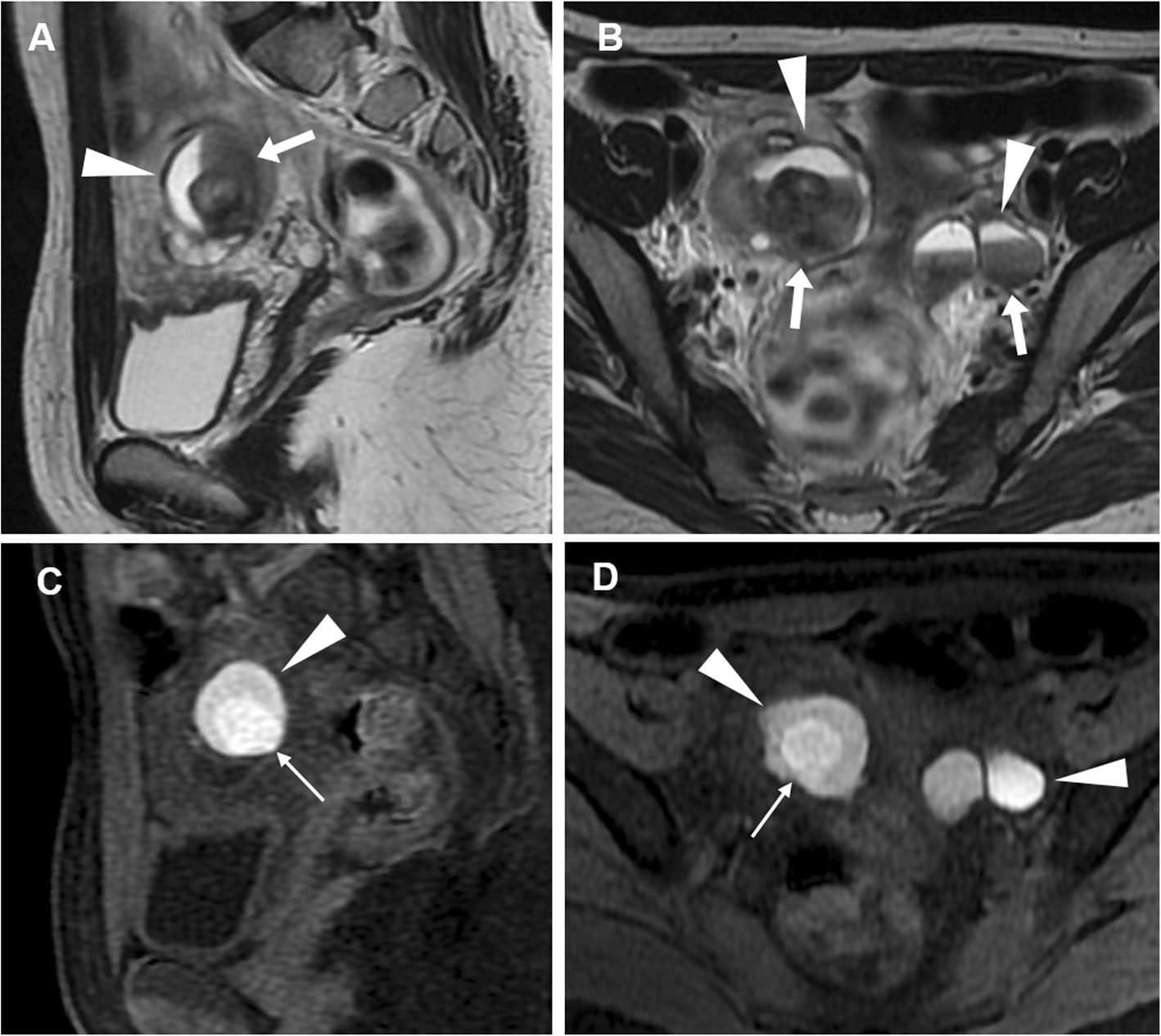 Fig. 10