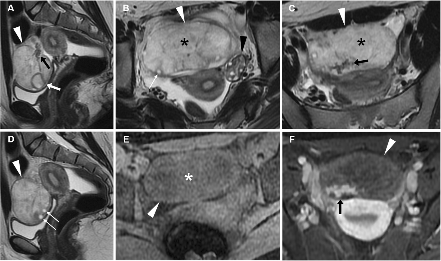 Fig. 19