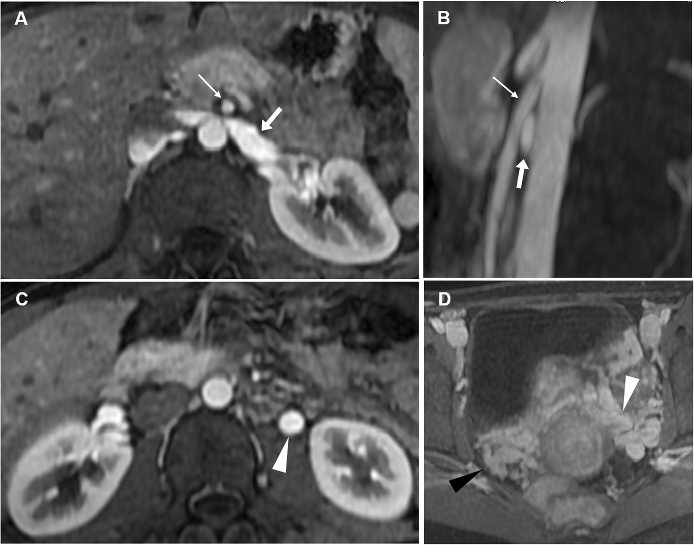 Fig. 23