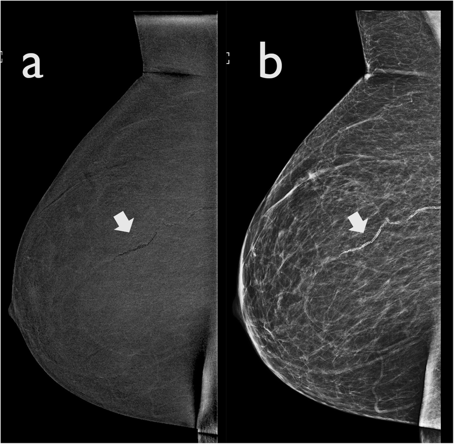 Fig. 9