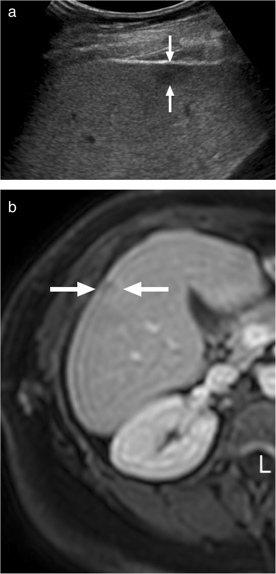 Fig. 10