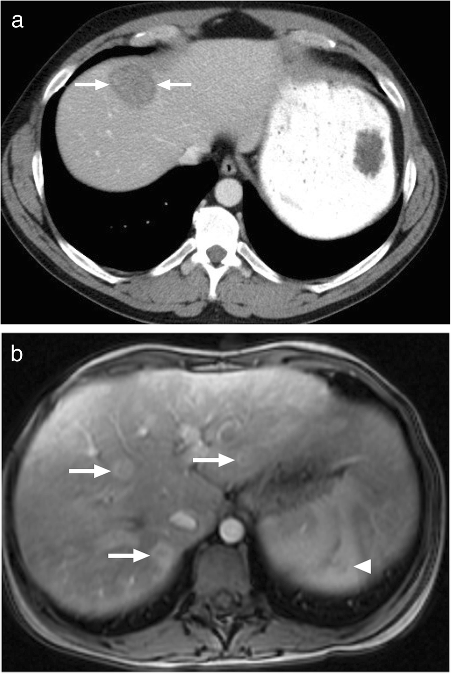 Fig. 14