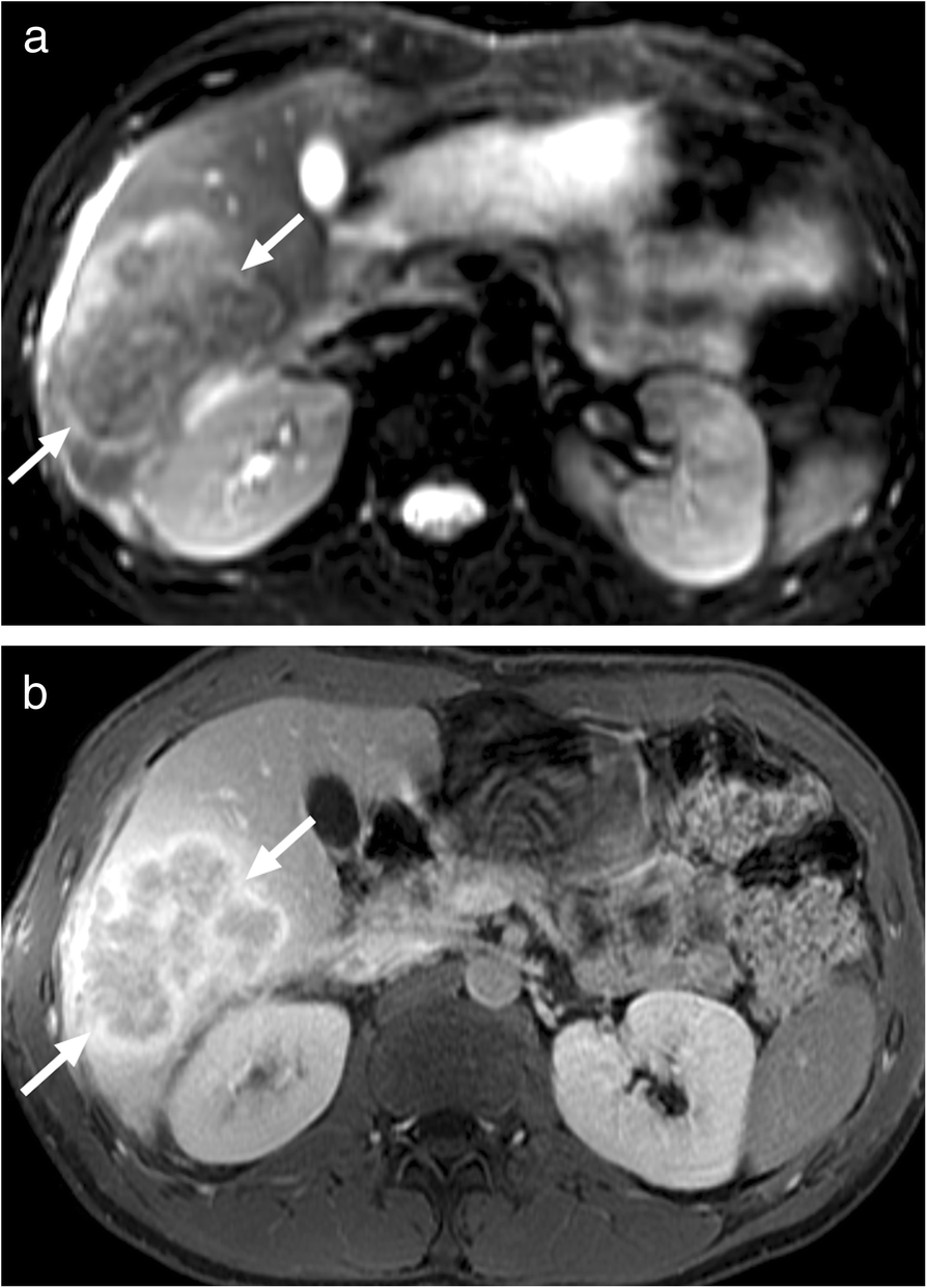 Fig. 20