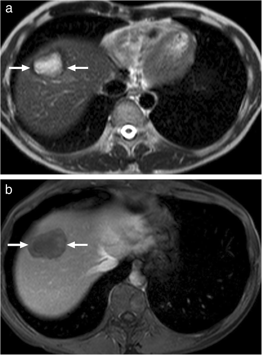 Fig. 21