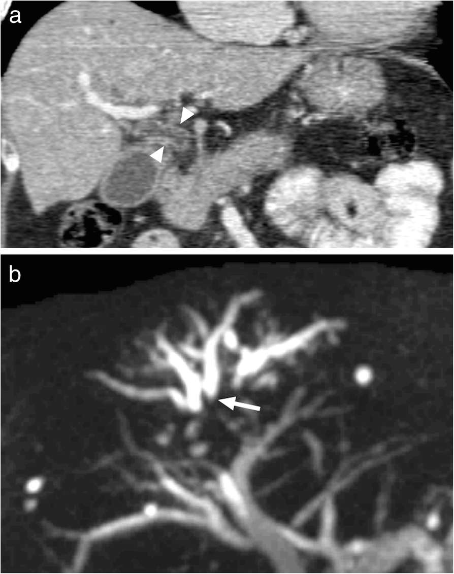 Fig. 26