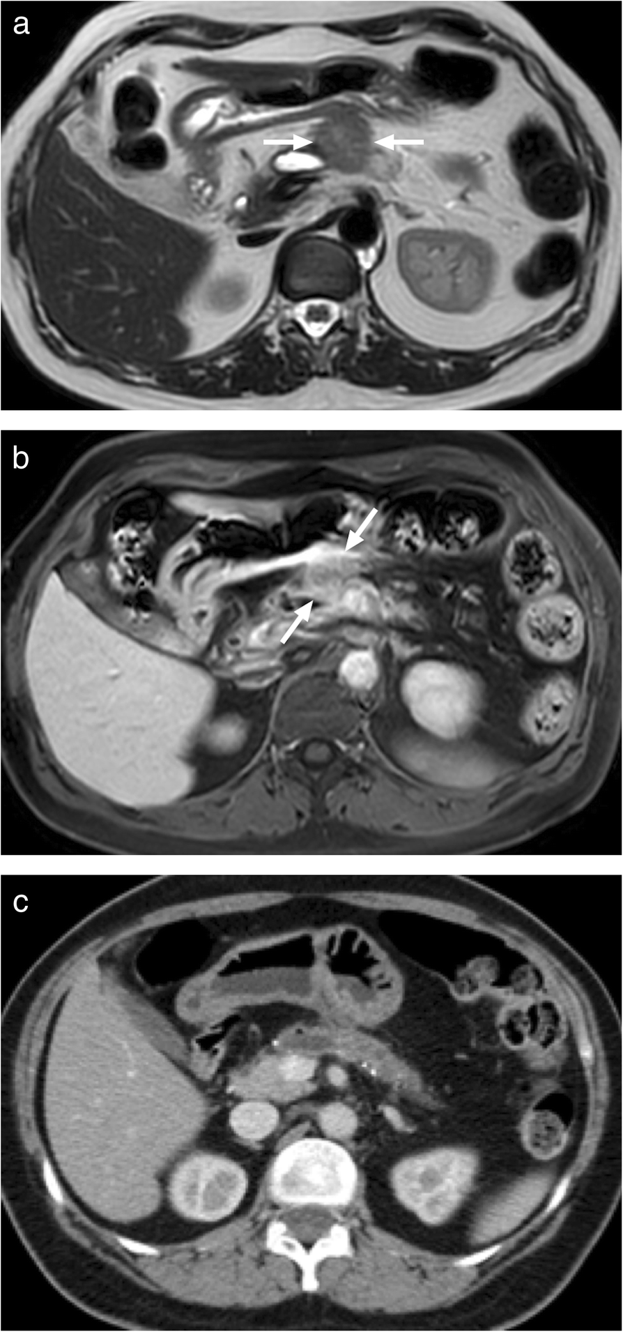 Fig. 28