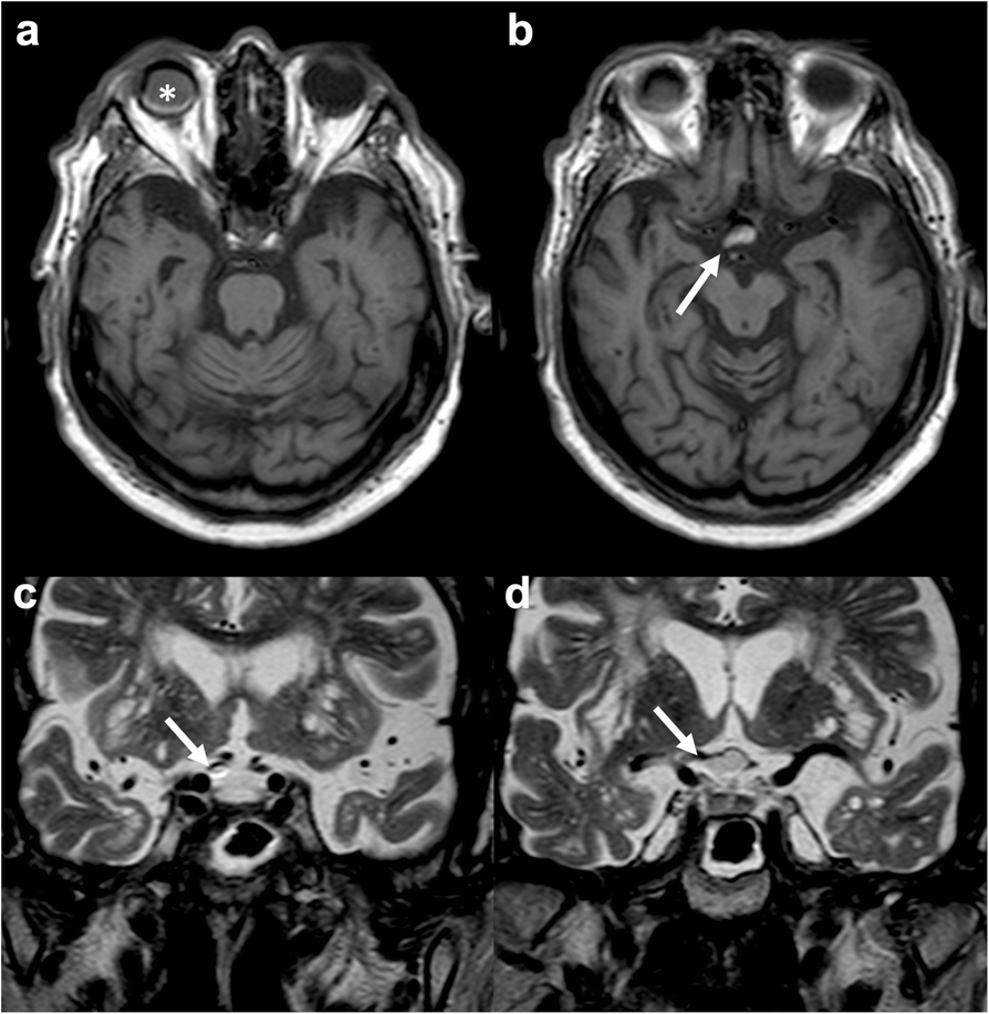 Fig. 9