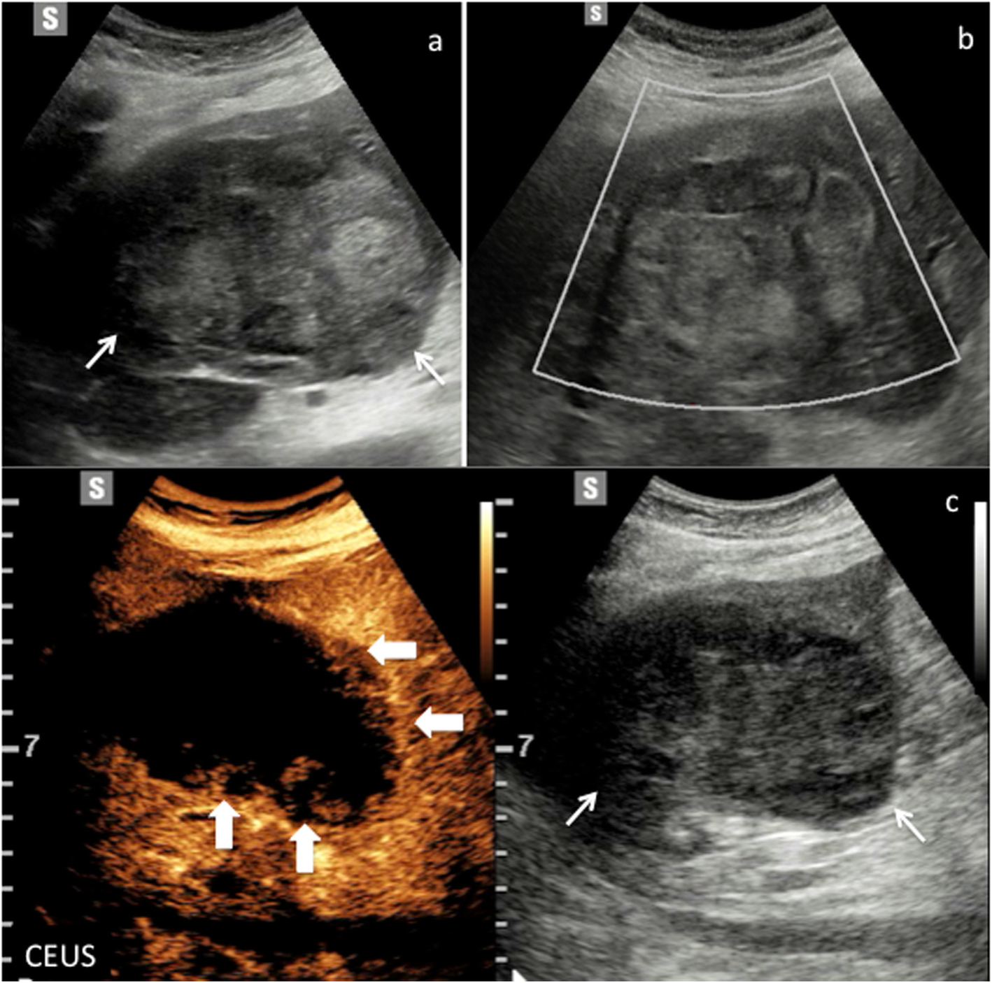 Fig. 10