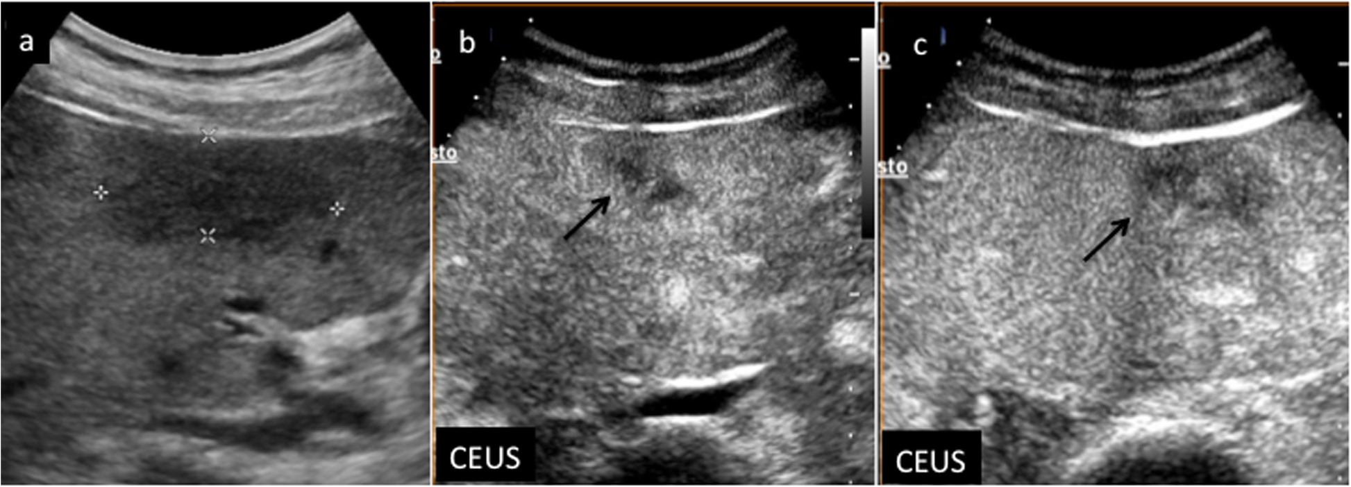 Fig. 11