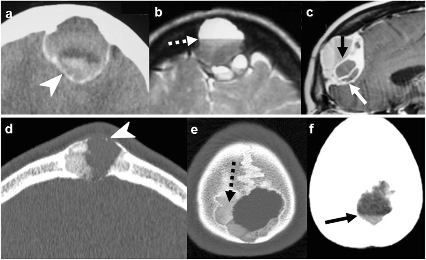 Fig. 6