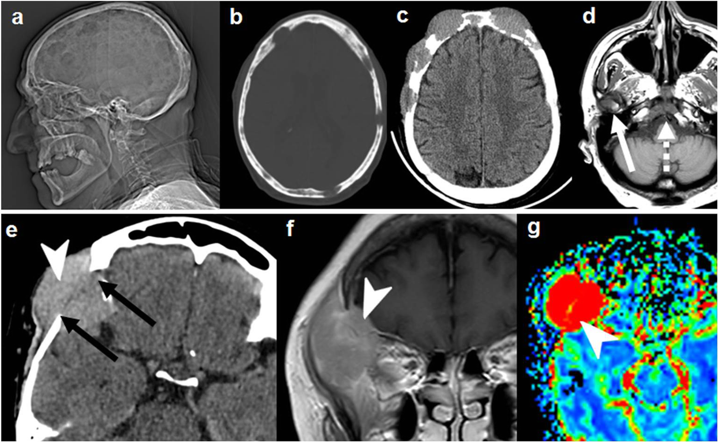 Fig. 9