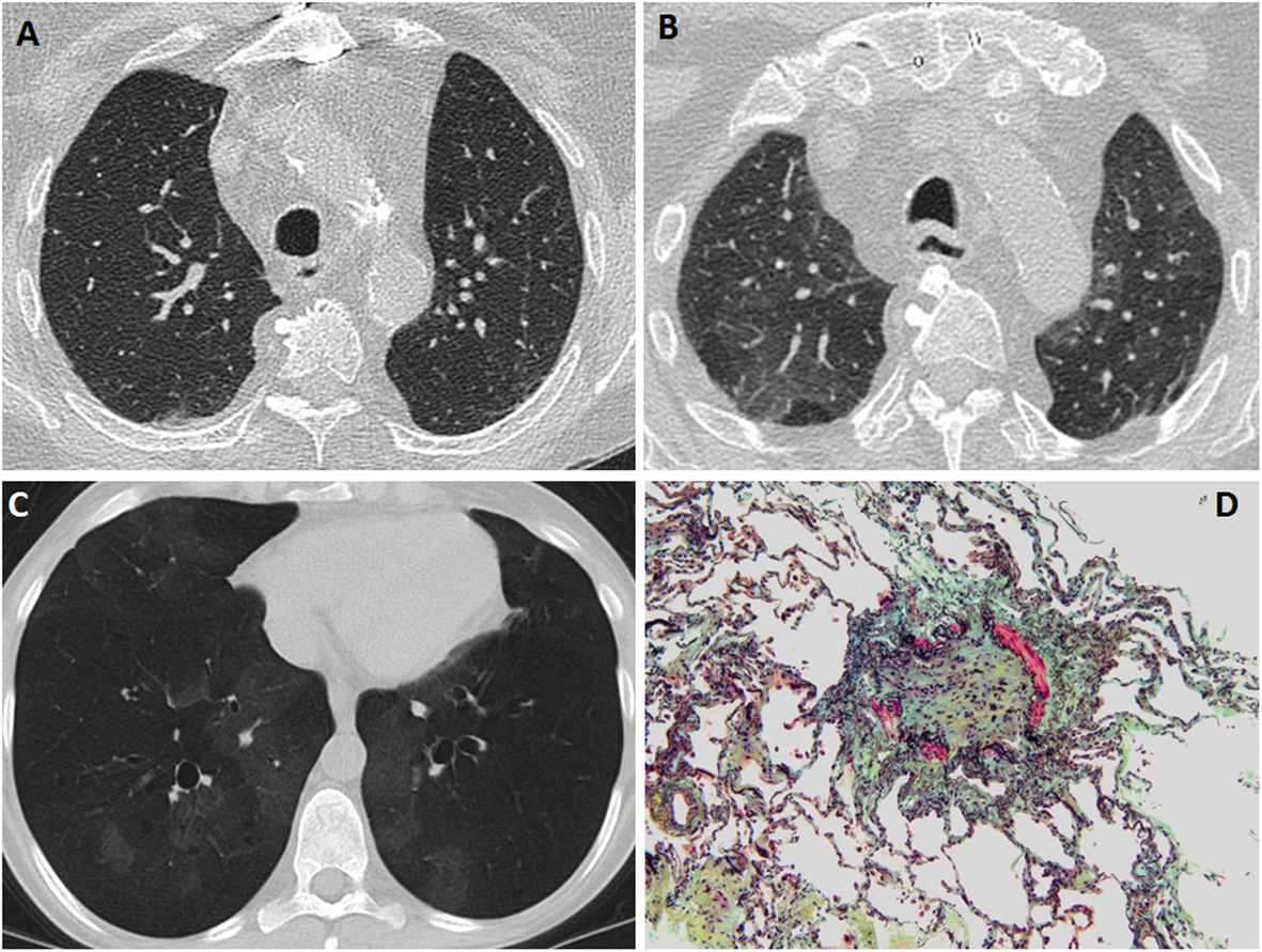 Fig. 7