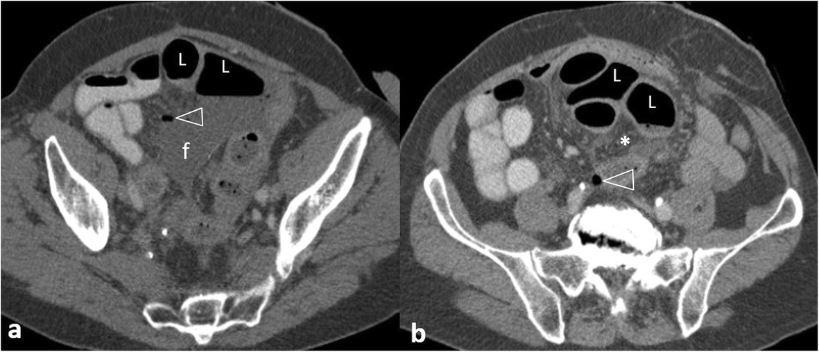 Fig. 12