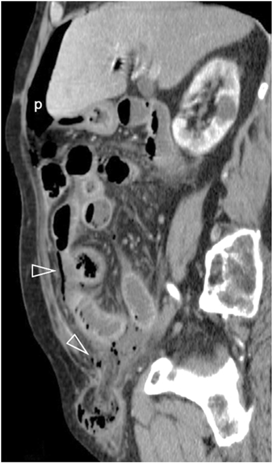 Fig. 13