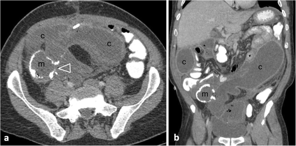 Fig. 19