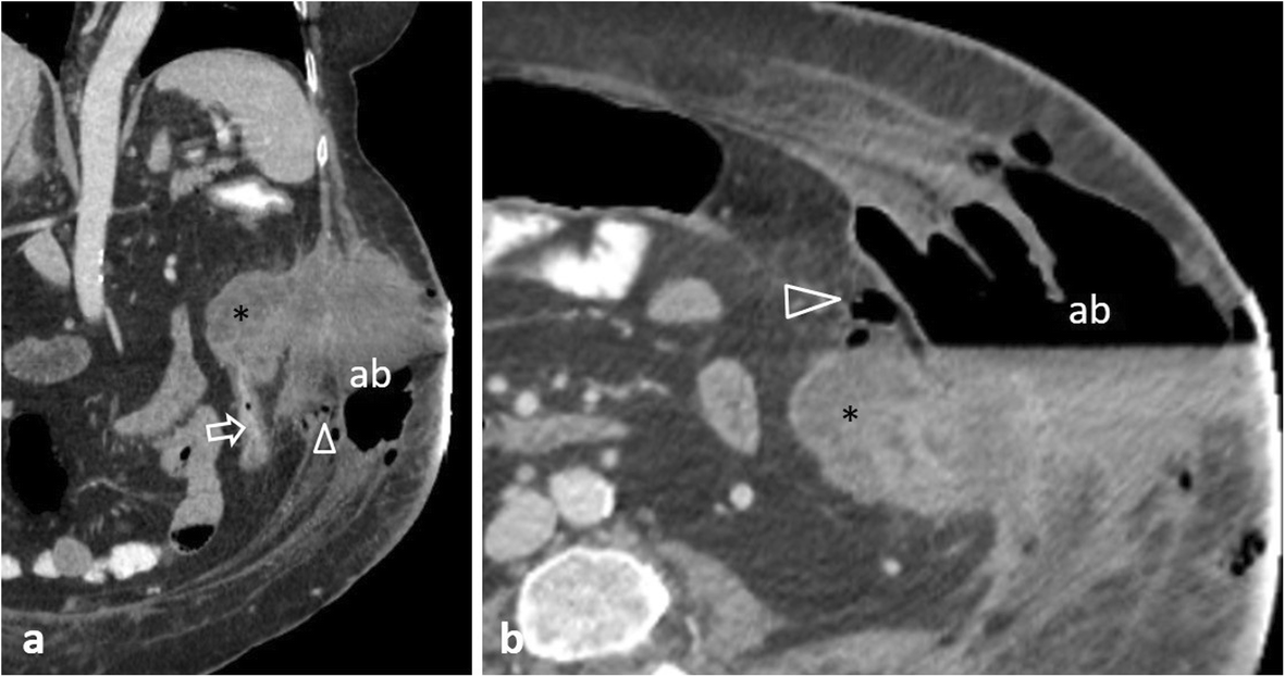 Fig. 21