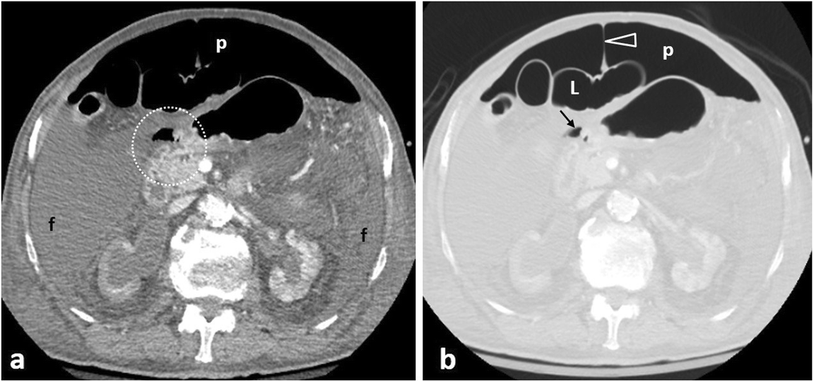 Fig. 5