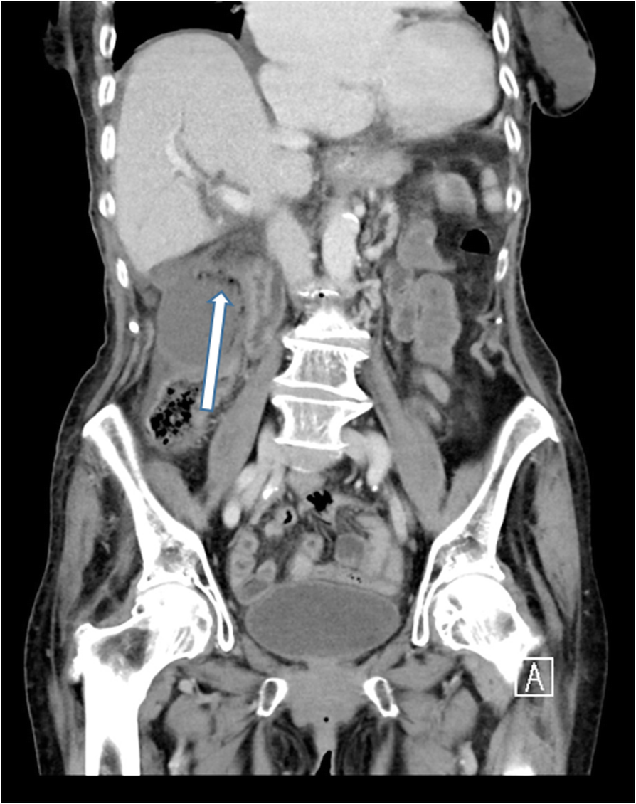 Fig. 11