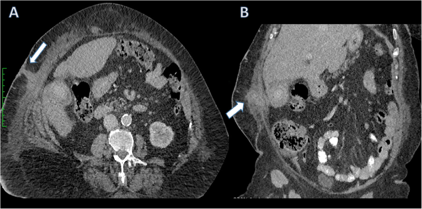 Fig. 13