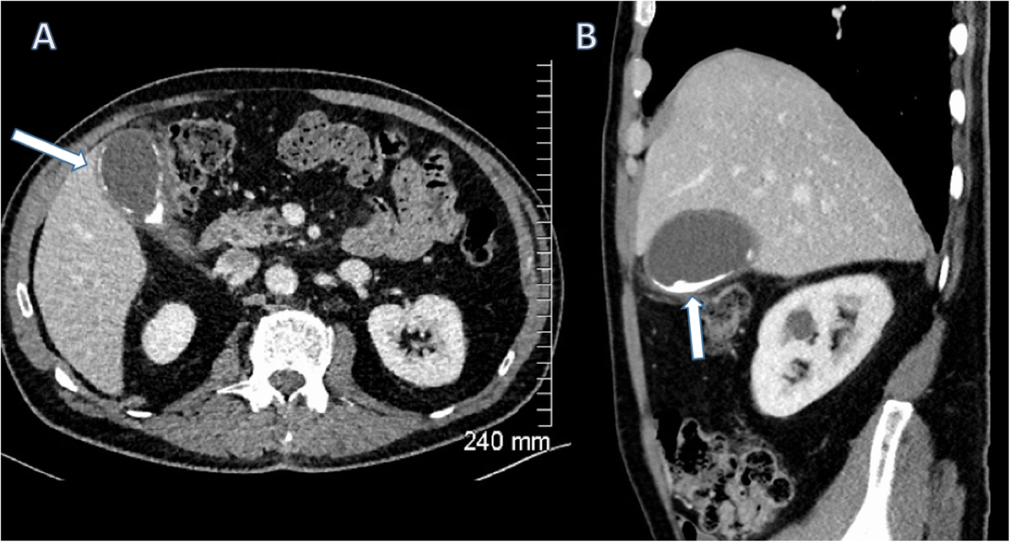 Fig. 15