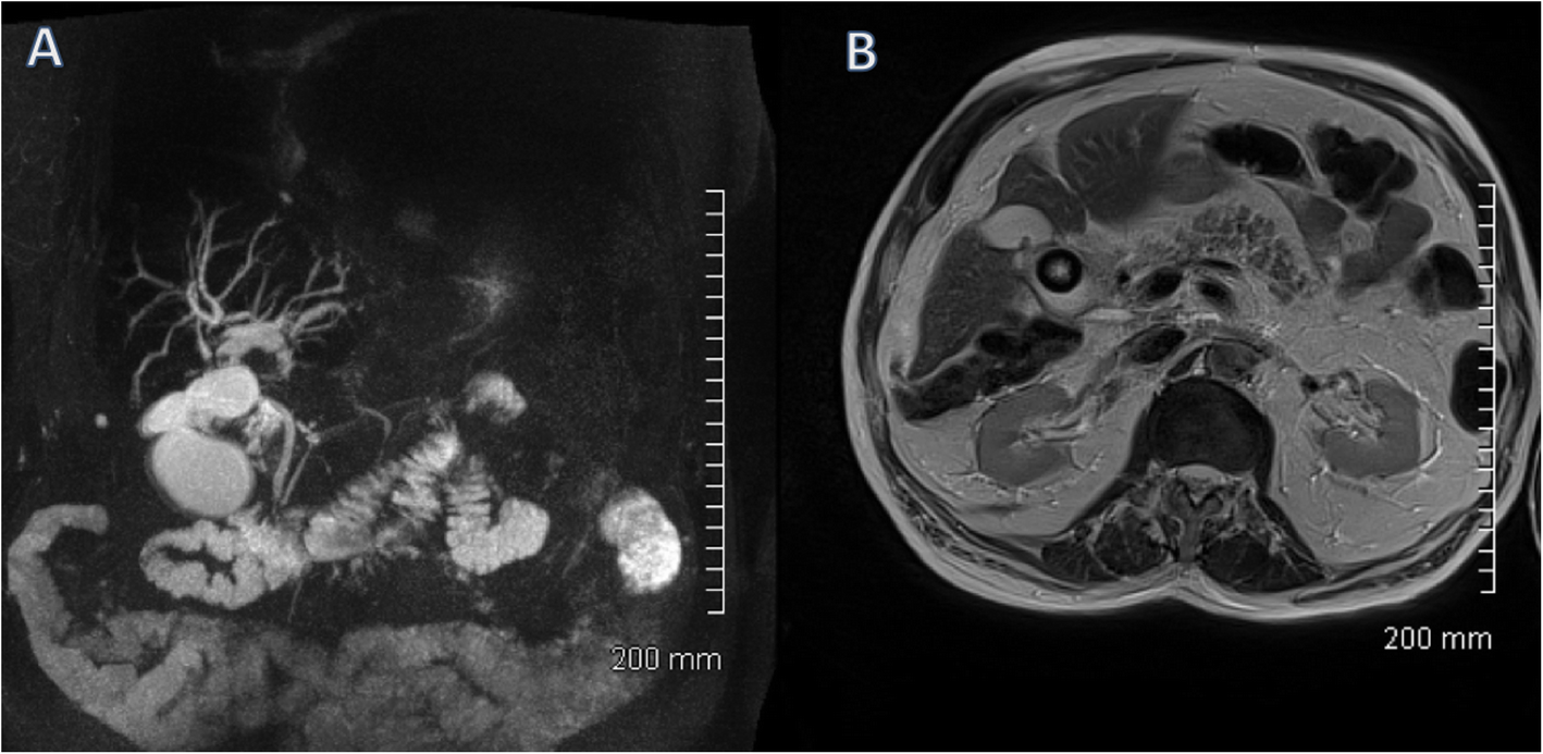 Fig. 18