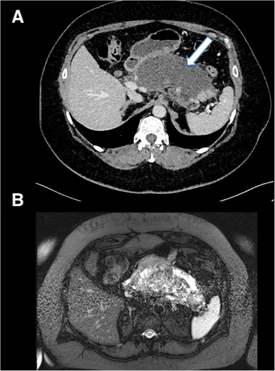 Fig. 20